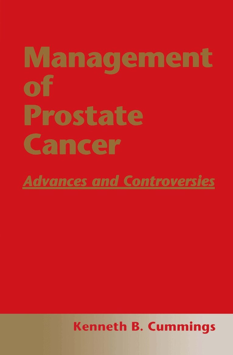 Kenneth B. Cummings - Management of Prostate Cancer, Inbunden. Tillgänglighet: Tillfälligt slut
