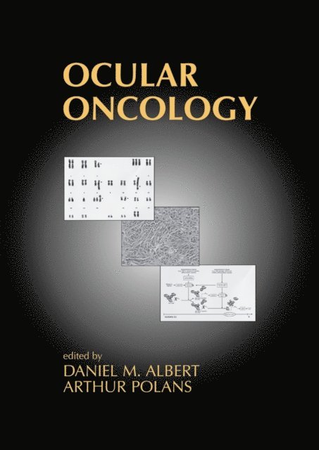 Arthur Polans, Daniel M. Albert - Ocular Oncology, E-bok