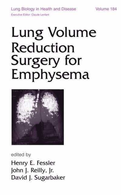 David Sugarbaker, Jr. John J. Reilly, Henry E. Fessler - Lung Volume Reduction Surgery for Emphysema, E-bok