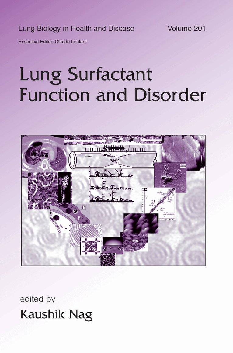Kaushik Nag - Lung Surfactant Function and Disorder, Inbunden. Tillgänglighet: Lägg i varukorg