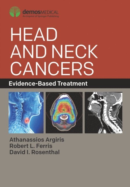 FASTRO David I. Rosenthal, MD, FACR, FACS Robert L. Ferris, MD, PhD, FACP Athanassios Argiris, MD - Head and Neck Cancers, E-bok