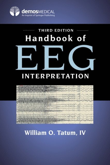 DO William O. Tatum, IV - Handbook of EEG Interpretation, E-bok