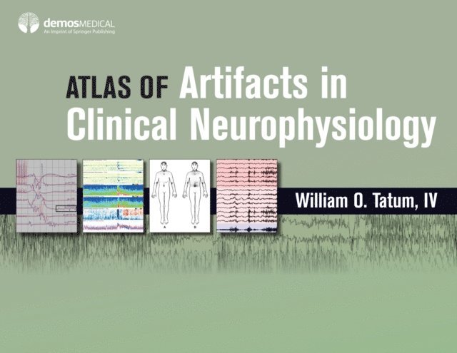 DO William O. Tatum, IV - Atlas of Artifacts in Clinical Neurophysiology, E-bok