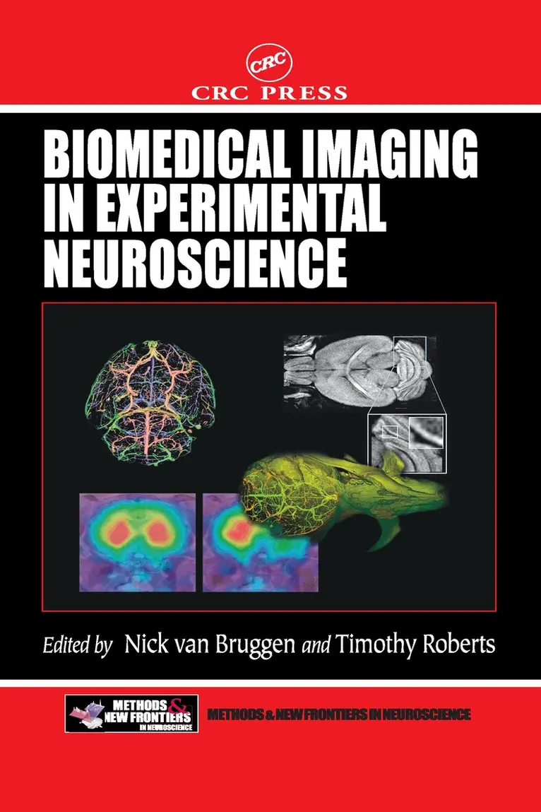 Nick Van Bruggen, Timothy P.L. Roberts - Biomedical Imaging in Experimental Neuroscience, Inbunden. Tillgänglighet: Tillfälligt slut