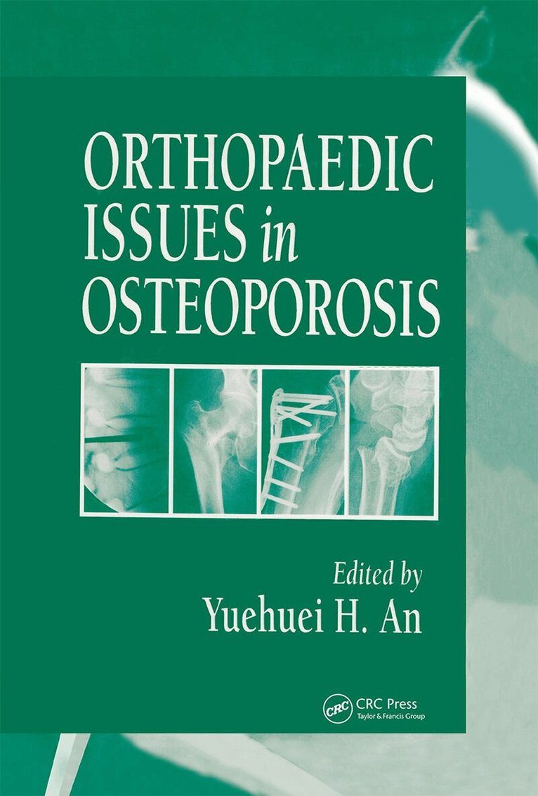 Yuehuei H. An - Orthopaedic Issues in Osteoporosis, Inbunden. Tillgänglighet: Lägg i varukorg