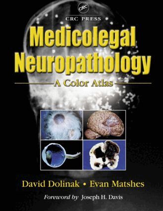 David Dolinak, Evan W. Matshes - Medicolegal Neuropathology, Inbunden