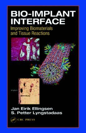 J.E. Ellingsen, S.P. Lyngstadaas - Bio-Implant Interface, Inbunden