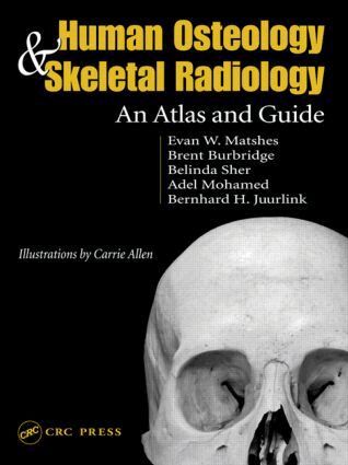 Evan W. Matshes, Bernard Juurlink - Human Osteology and Skeletal Radiology, Inbunden. Tillgänglighet: Tillfälligt slut