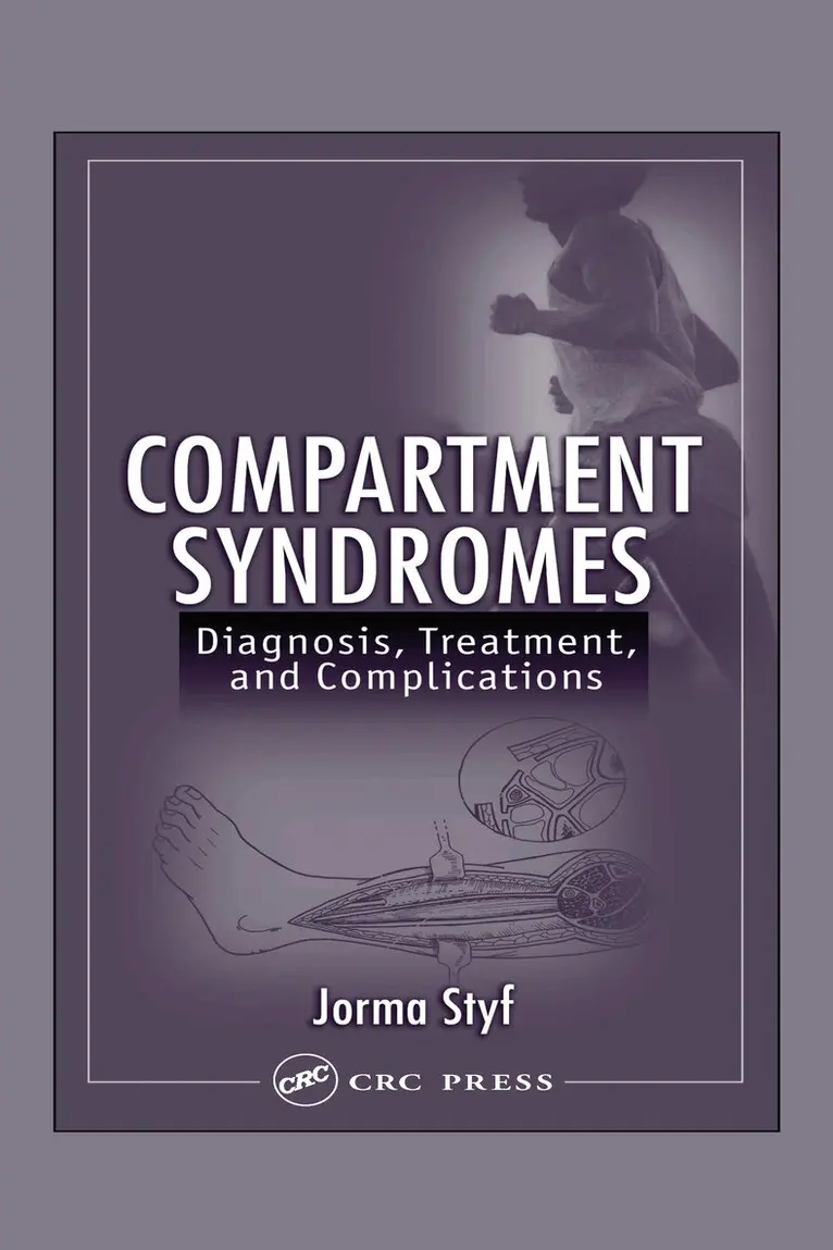Jorma Styf - Compartment Syndromes, Inbunden. Tillgänglighet: Tillfälligt slut