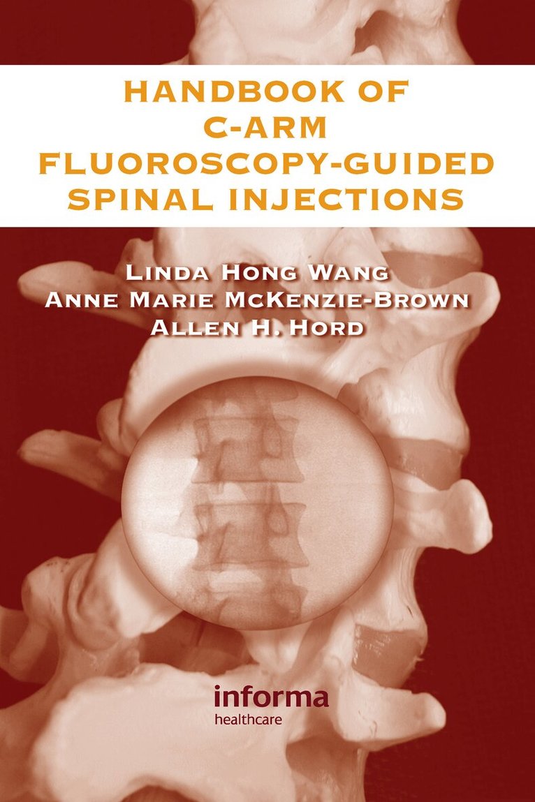 Linda Hong Wang, Anne Marie McKenzie-Brown, Allen Hord - Handbook of C-Arm Fluoroscopy-Guided Spinal Injections, Inbunden
