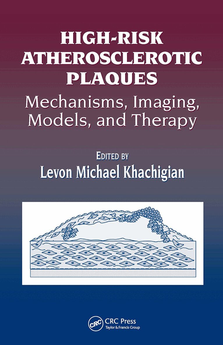 Levon Michael Khachigian - High-Risk Atherosclerotic Plaques, Inbunden. Tillgänglighet: Tillfälligt slut