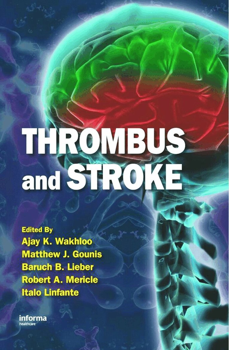 Ajay K. Wakhloo, Matthew J. Gounis, Baruch B. Lieber, Robert A. Mericle, Italo Linfante - Thrombus and Stroke, Inbunden