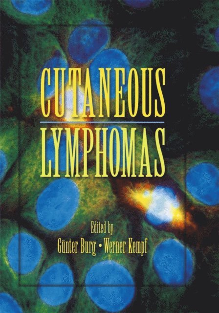 Werner Kempf, Gunter Burg - Cutaneous Lymphomas, E-bok
