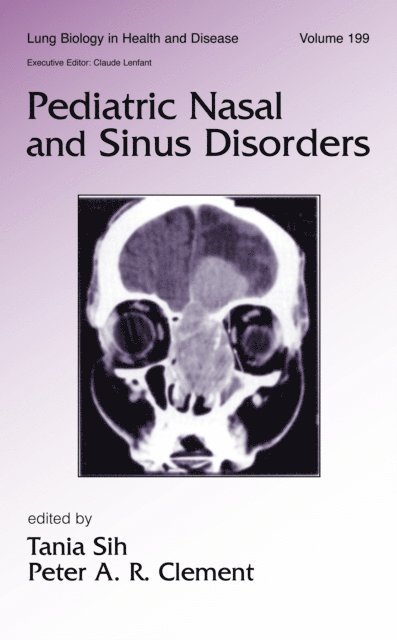 Peter A.R. Clement, Tania Sih - Pediatric Nasal and Sinus Disorders, E-bok. Tillgänglighet: Lägg i varukorg