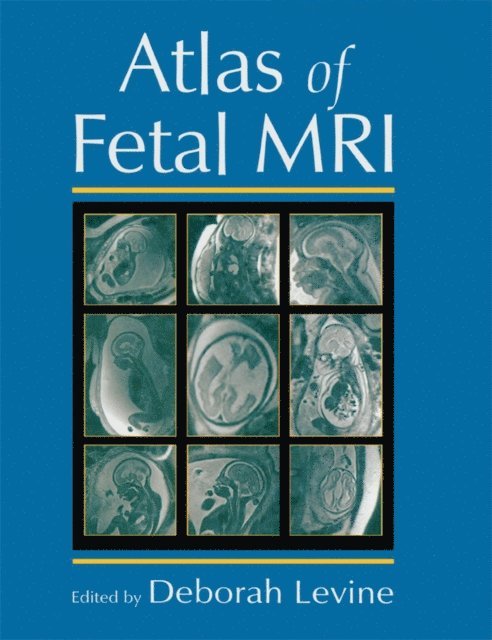 Deborah Levine - Atlas of Fetal MRI, E-bok
