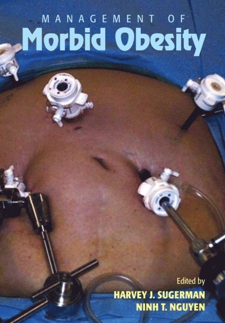Ninh Nguyen, Harvey J. Sugerman - Management of Morbid Obesity, E-bok
