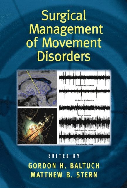 Matthew B. Stern, Gordon H. Baltuch - Surgical Management of Movement Disorders, E-bok