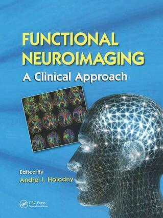 Andrei I. Holodny - Functional Neuroimaging, Inbunden