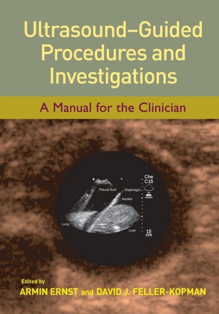 David J. Feller-Kopman, Armin Ernst - Ultrasound-Guided Procedures and Investigations, E-bok