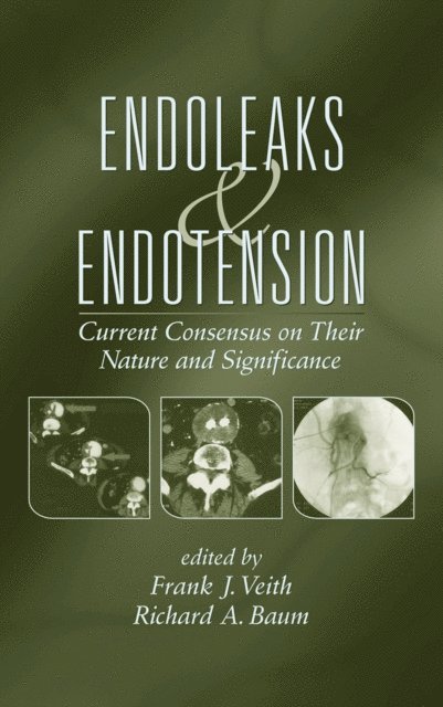 Richard Baum, Frank J. Veith - Endoleaks and Endotension, E-bok