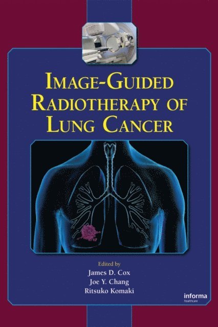 Ritsuko Komaki, Joe Y. Chang, James D. Cox - Image-Guided Radiotherapy of Lung Cancer, E-bok