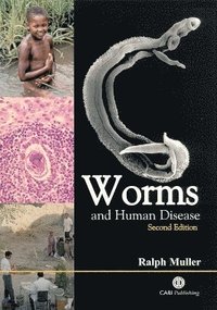 Worms and Human Disease