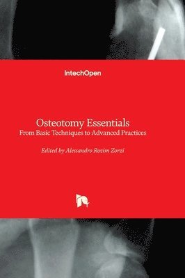 Alessandro Rozim Zorzi, Alessandro Rozim Zorzi - Osteotomy Essentials, Inbunden