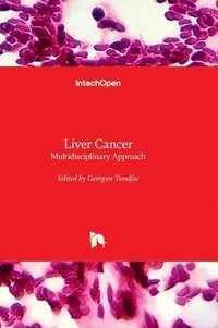 Liver Cancer