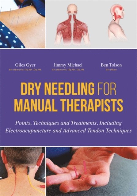 Giles Gyer, Jimmy Michael, Ben Tolson - Dry Needling for Manual Therapists, E-bok