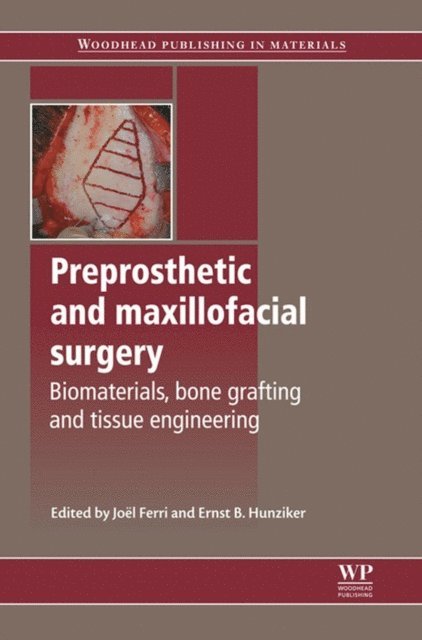 E Hunziker, J Ferri - Preprosthetic and Maxillofacial Surgery, E-bok