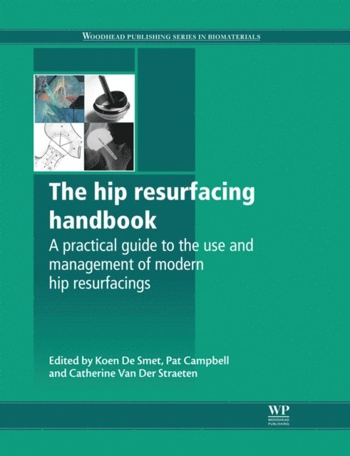 C Van Der Straeten, P. N. Campbell, K De Smet - Hip Resurfacing Handbook, E-bok