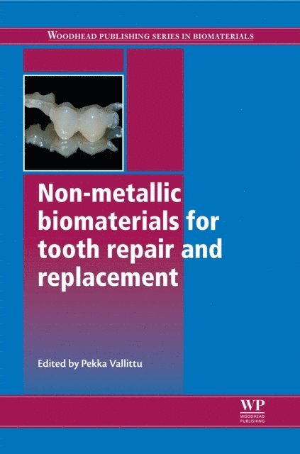 P Vallittu - Non-Metallic Biomaterials for Tooth Repair and Replacement, E-bok. Tillgänglighet: Lägg i varukorg