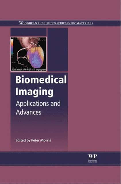 Peter Morris - Biomedical Imaging, E-bok