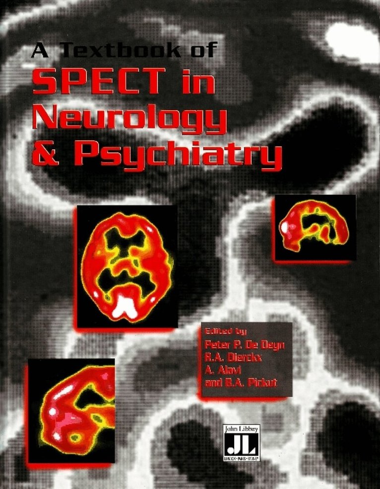 P P De Deyn, R A Dierckx, A Alavi, B A Pickut - Textbook of SPECT in Neurology & Psychiatry, Häftad