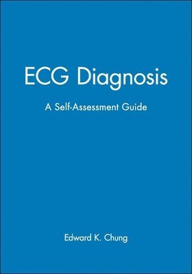 Edward K. Chung - ECG Diagnosis, Häftad. Tillgänglighet: Tillfälligt slut