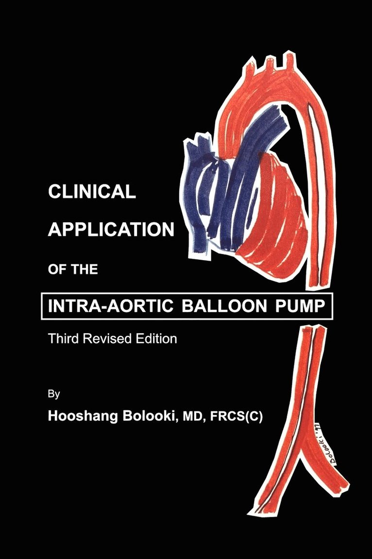 Clinical Application of Intra-Aortic Balloon Pump
