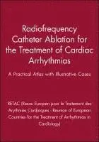 Radiofrequency Catheter Ablation for the Treatment of Cardiac Arrhythmias