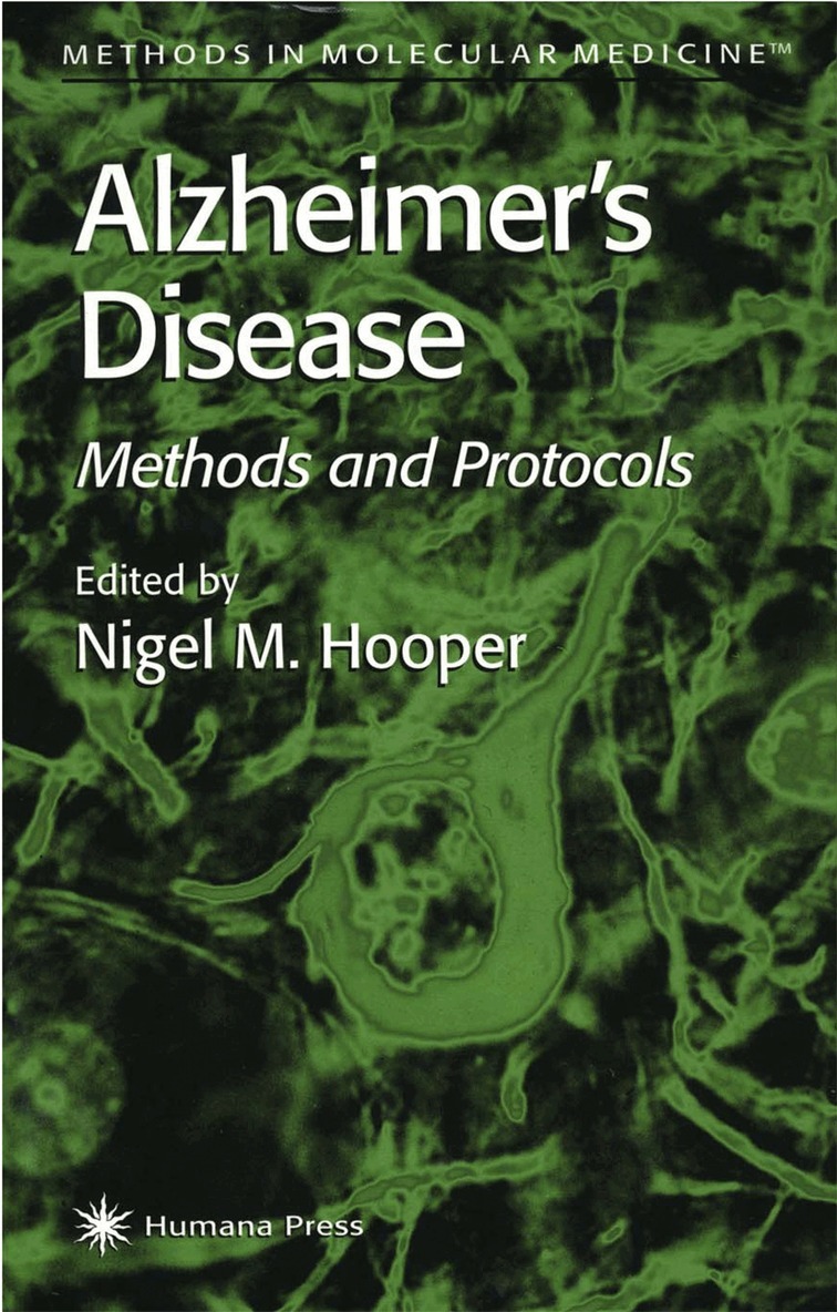 Nigel M. Hooper - Alzheimer's Disease, Inbunden. Tillgänglighet: Lägg i varukorg