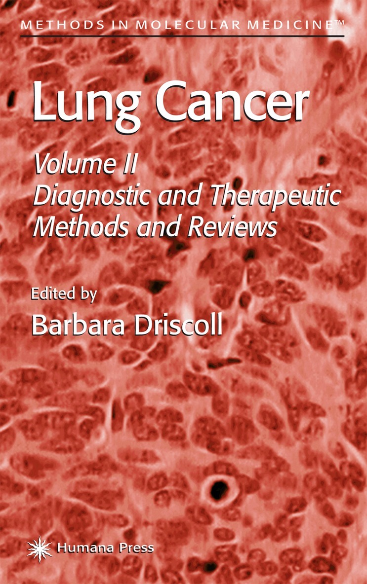 Barbara Driscoll, Barbara Driscoll - Lung Cancer, Inbunden