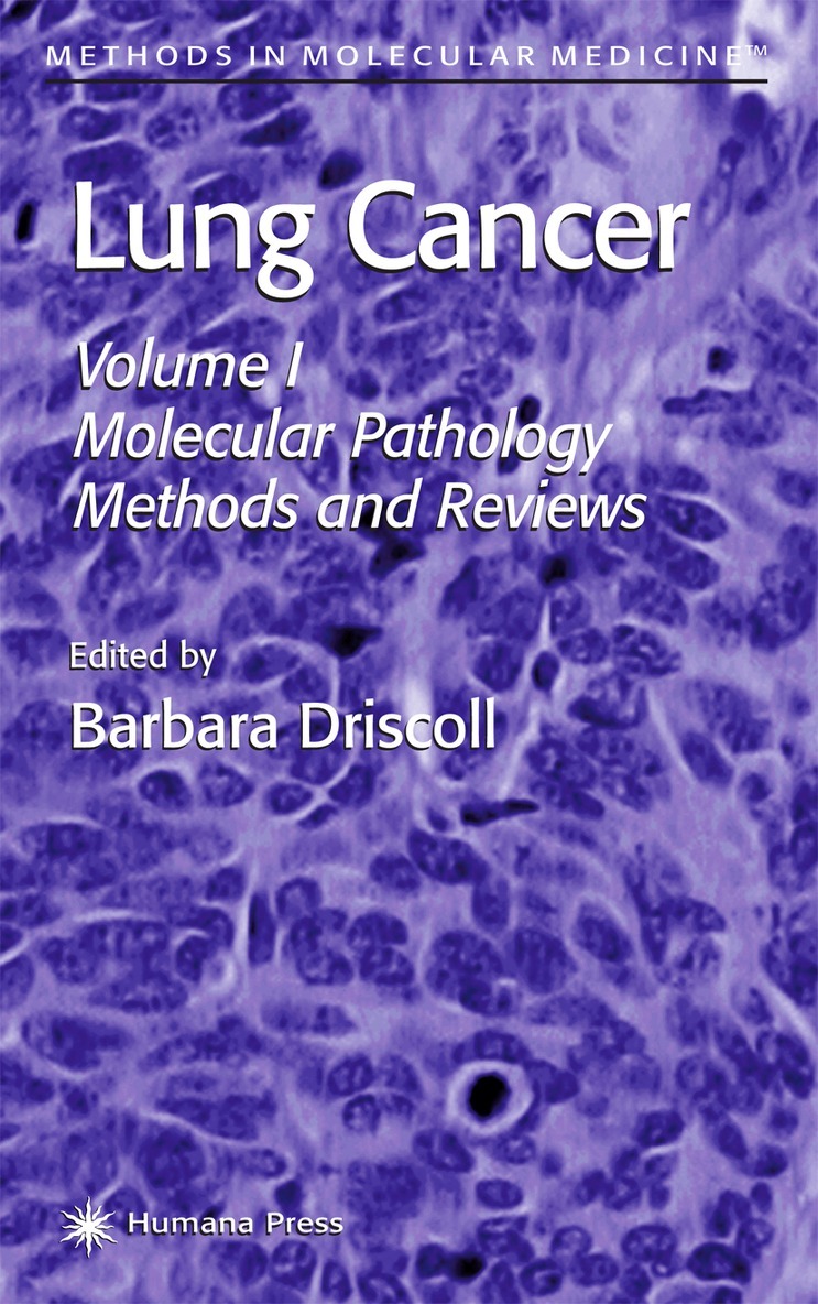Barbara Driscoll - Lung Cancer, Inbunden. Tillgänglighet: Lägg i varukorg