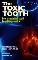 Robert Kulacz, Jd Levy - The Toxic Tooth: How a root canal could be making you sick, Häftad