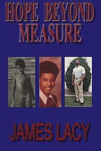 James Lacy - Hope Beyond Measure, Häftad