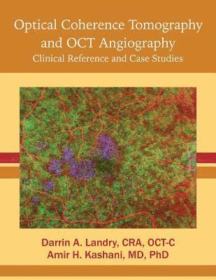 Cra Oct-C Darrin a. Landry, Ph. D. Amir Kashani - Optical Coherence Tomography and OCT Angiography: Clinical Reference and Case Studies, Häftad