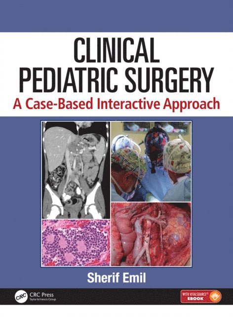 Sherif Emil - Clinical Pediatric Surgery, E-bok
