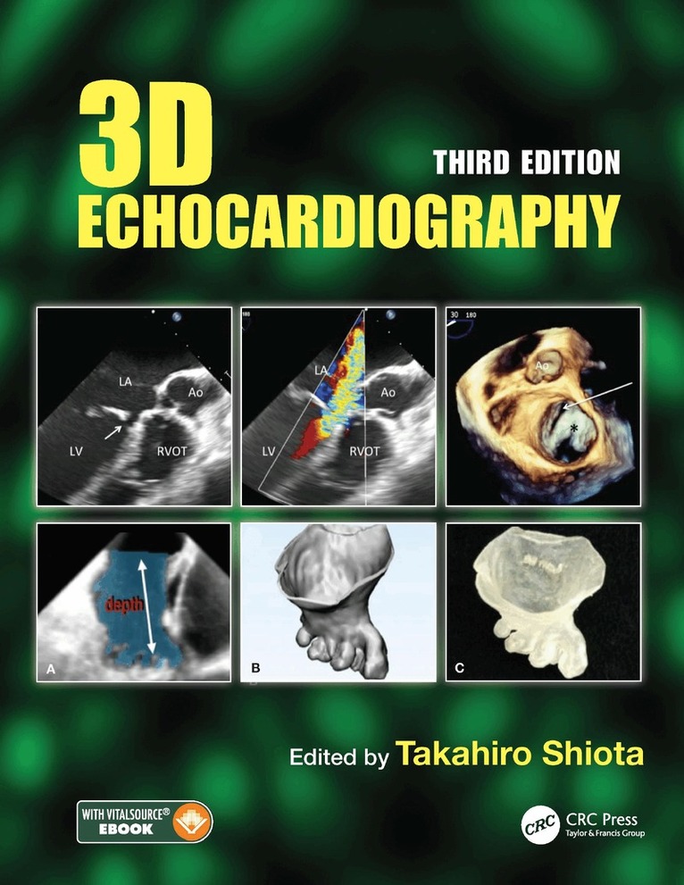 Takahiro Shiota - 3D Echocardiography, E-bok