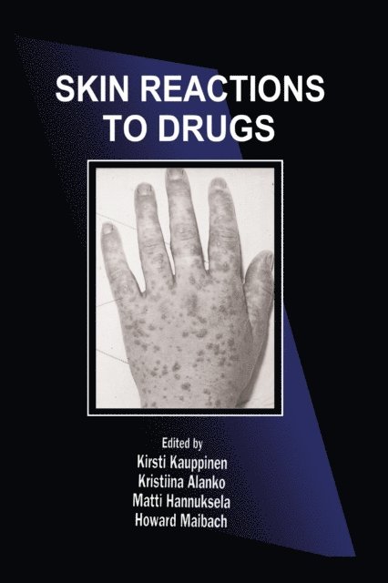 Howard I. Maibach, Matti Hannuksela, Kristiina Alanko, Kirsti Kauppinen - Skin Reactions to Drugs, E-bok