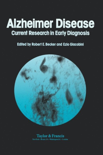 Robert Becker - Alzheimer's Disease, E-bok
