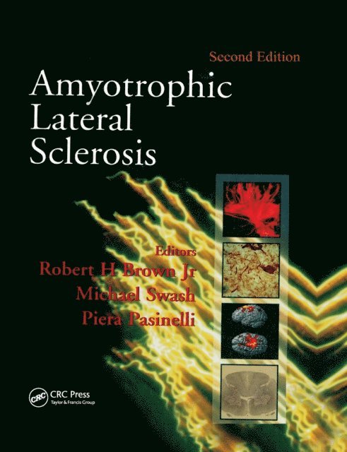 Piera Pasinelli, Michael Swash, Robert H. Brown - Amyotrophic Lateral Sclerosis, Second Edition, E-bok