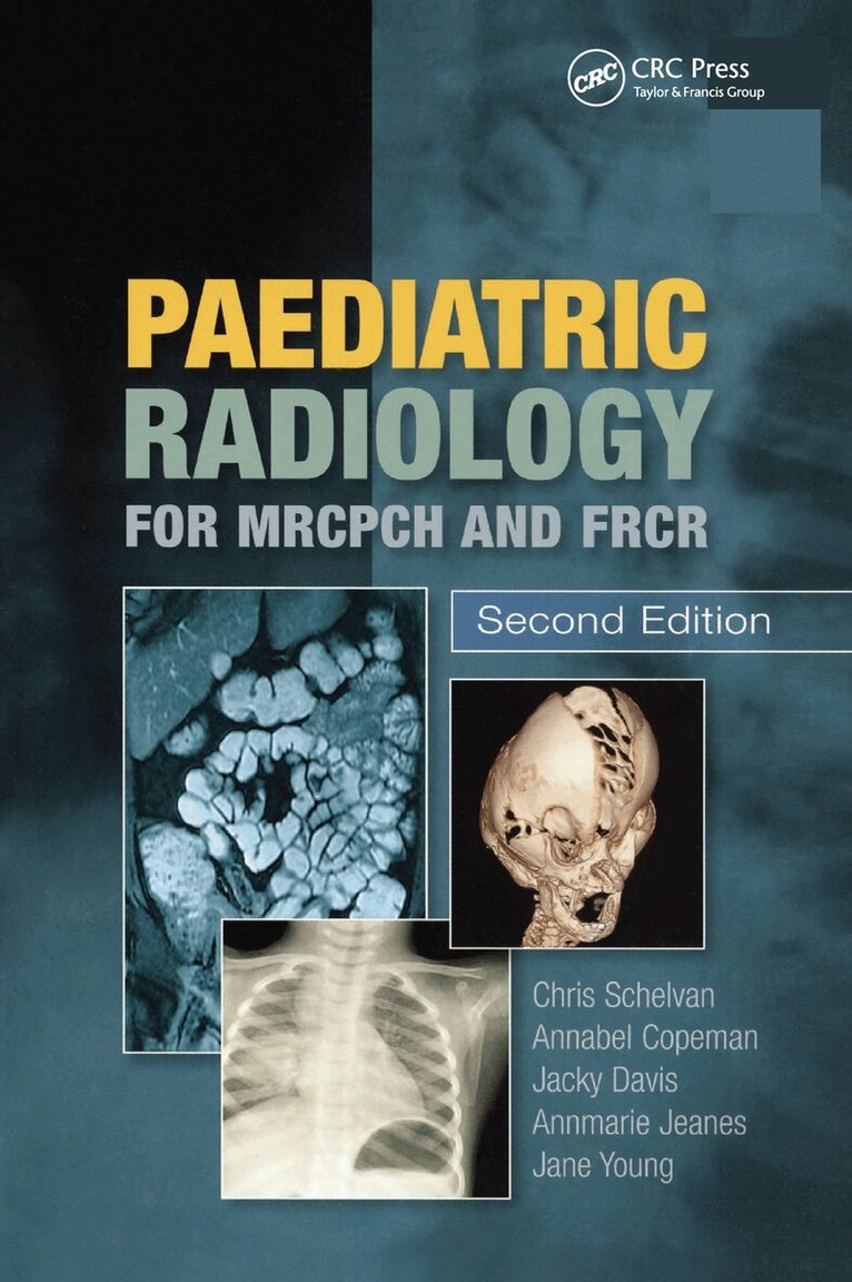Christopher Schelvan, Annabel Copeman, Jacqueline Davis, Jane Young, Annmarie Jeanes, Christopher Schelvan, Annabel Copeman, Jacqueline Davis, Annmarie Jeanes, Jane Young - Paediatric Radiology for MRCPCH and FRCR, Second Edition, E-bok