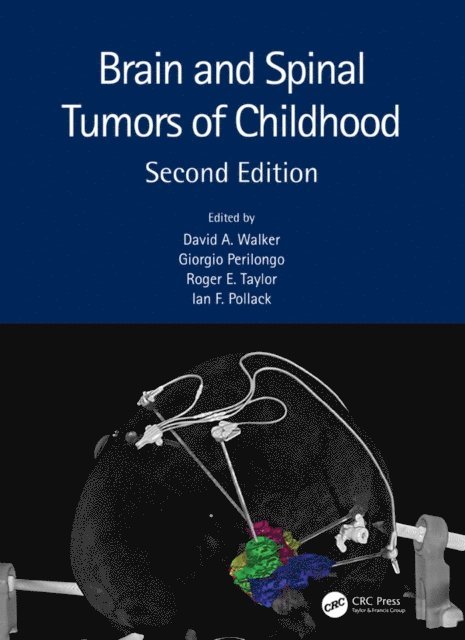 Ian F. Pollack, Roger E. Taylor, Giorgio Perilongo, David A. Walker - Brain and Spinal Tumors of Childhood, E-bok